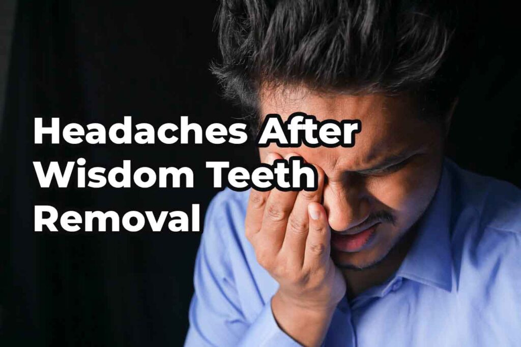 Headaches After Wisdom Teeth Removal